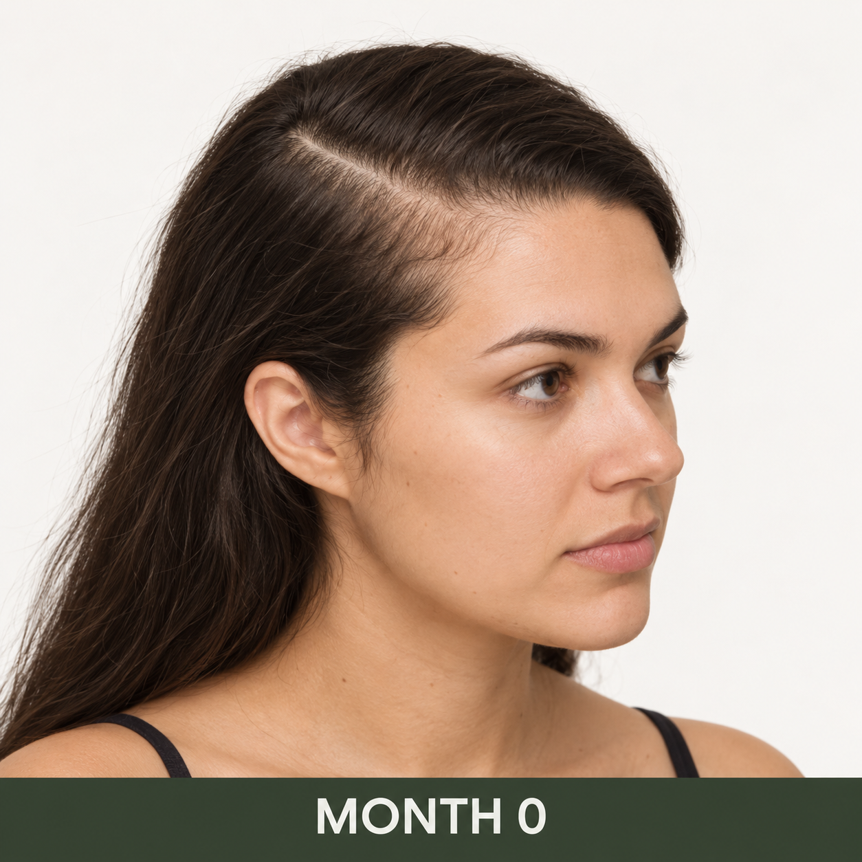 MONTH 0
